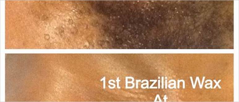 Brazilian and bikini wax